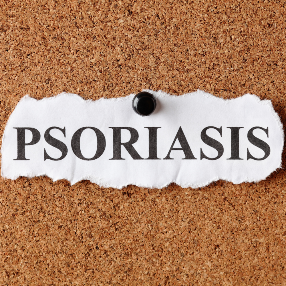 Underlying Causes of Psoriasis
