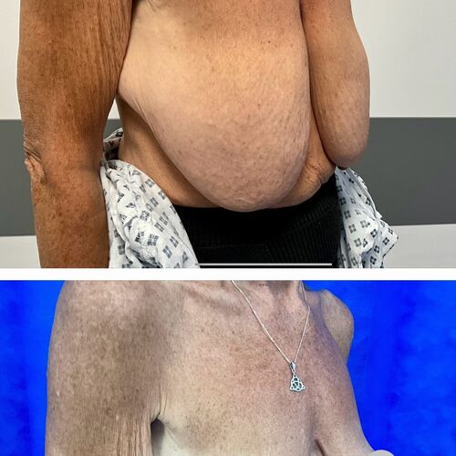Gallery | FM Plastic Surgery Ltd  | Plastic Surgeon Newcastle | Cosmetic Surgery Newcastle | Skin and Hand Surgery North East