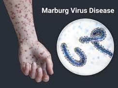 Ethiopia confirms first outbreak of Marburg virus disease