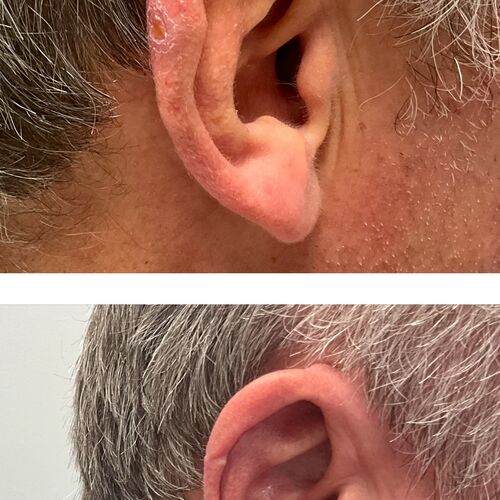 Gallery | FM Plastic Surgery Ltd  | Plastic Surgeon Newcastle | Cosmetic Surgery Newcastle | Skin and Hand Surgery North East