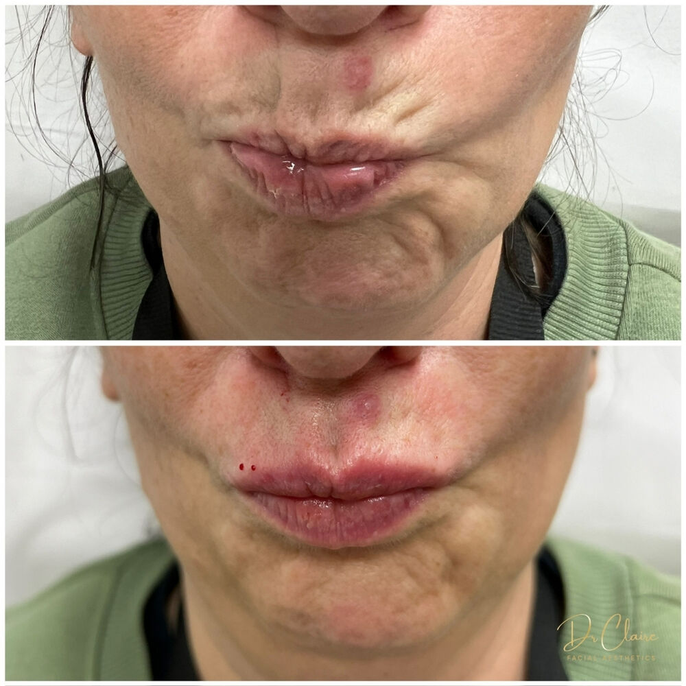 Transformations | Dr Claire Facial Aesthetics | Botox Chorley | Fillers Chorley | Aesthetics Chorley | Botox Treatments Chorley | Dermal Fillers Chorley | Aesthetic Enhancements Chorley
