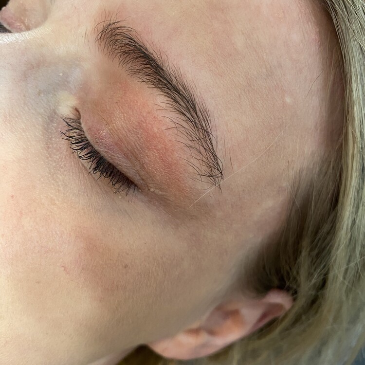 Before & After Results