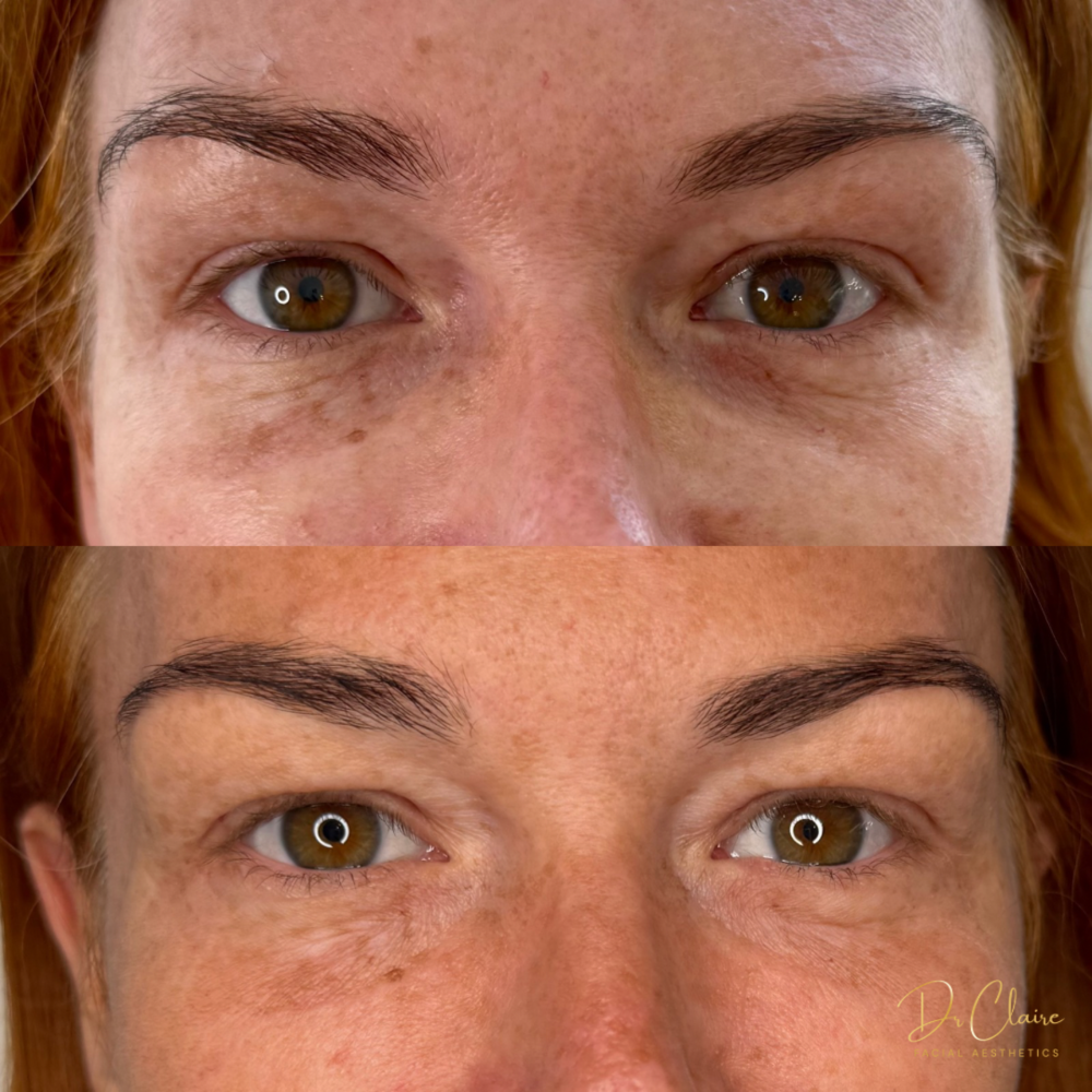 Transformations | Dr Claire Facial Aesthetics | Botox Chorley | Fillers Chorley | Aesthetics Chorley | Botox Treatments Chorley | Dermal Fillers Chorley | Aesthetic Enhancements Chorley