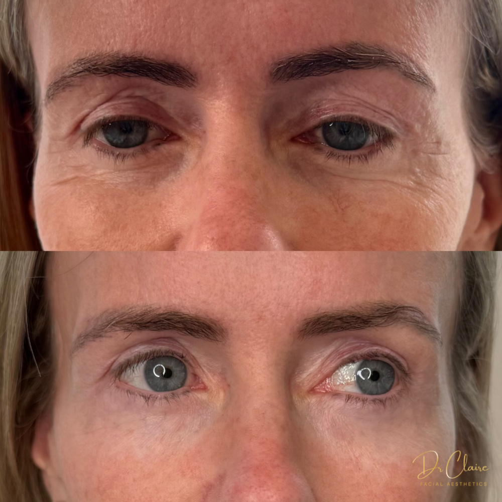 Transformations | Dr Claire Facial Aesthetics | Botox Chorley | Fillers Chorley | Aesthetics Chorley | Botox Treatments Chorley | Dermal Fillers Chorley | Aesthetic Enhancements Chorley
