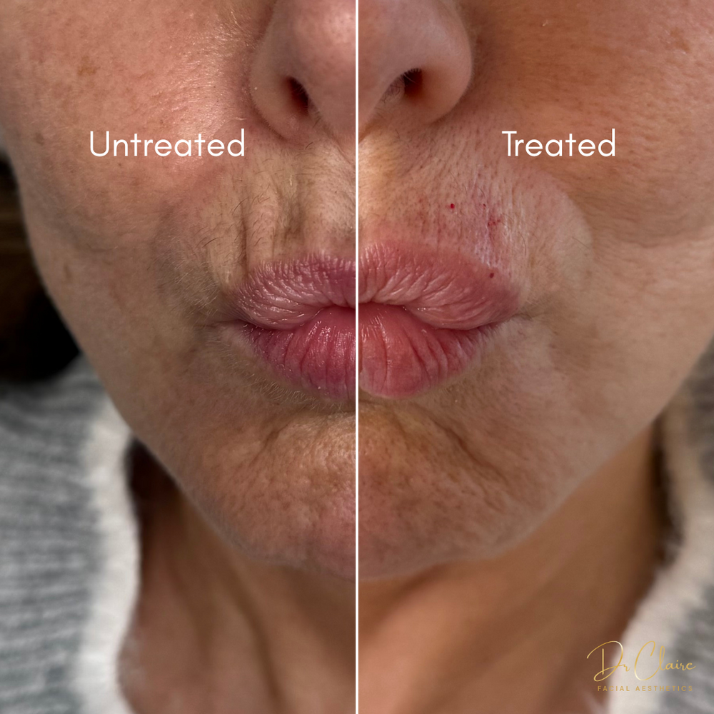 Transformations | Dr Claire Facial Aesthetics | Botox Chorley | Fillers Chorley | Aesthetics Chorley | Botox Treatments Chorley | Dermal Fillers Chorley | Aesthetic Enhancements Chorley
