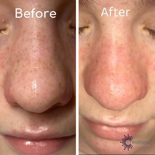 DERMALOGICA SKIN SERVICES | Creations Skincare Centre Ltd | Dermalogica Derby | Elemis Derby | Beauty Salon Mickleover
