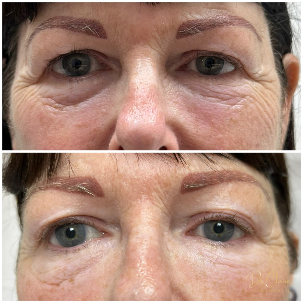 Transformations | Dr Claire Facial Aesthetics | Botox Chorley | Fillers Chorley | Aesthetics Chorley | Botox Treatments Chorley | Dermal Fillers Chorley | Aesthetic Enhancements Chorley