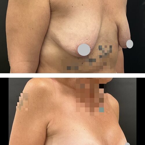 Gallery | FM Plastic Surgery Ltd  | Plastic Surgeon Newcastle | Cosmetic Surgery Newcastle | Skin and Hand Surgery North East