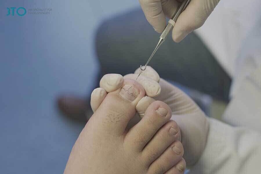 Podiatrist in Glossop | Shire Foot Clinic