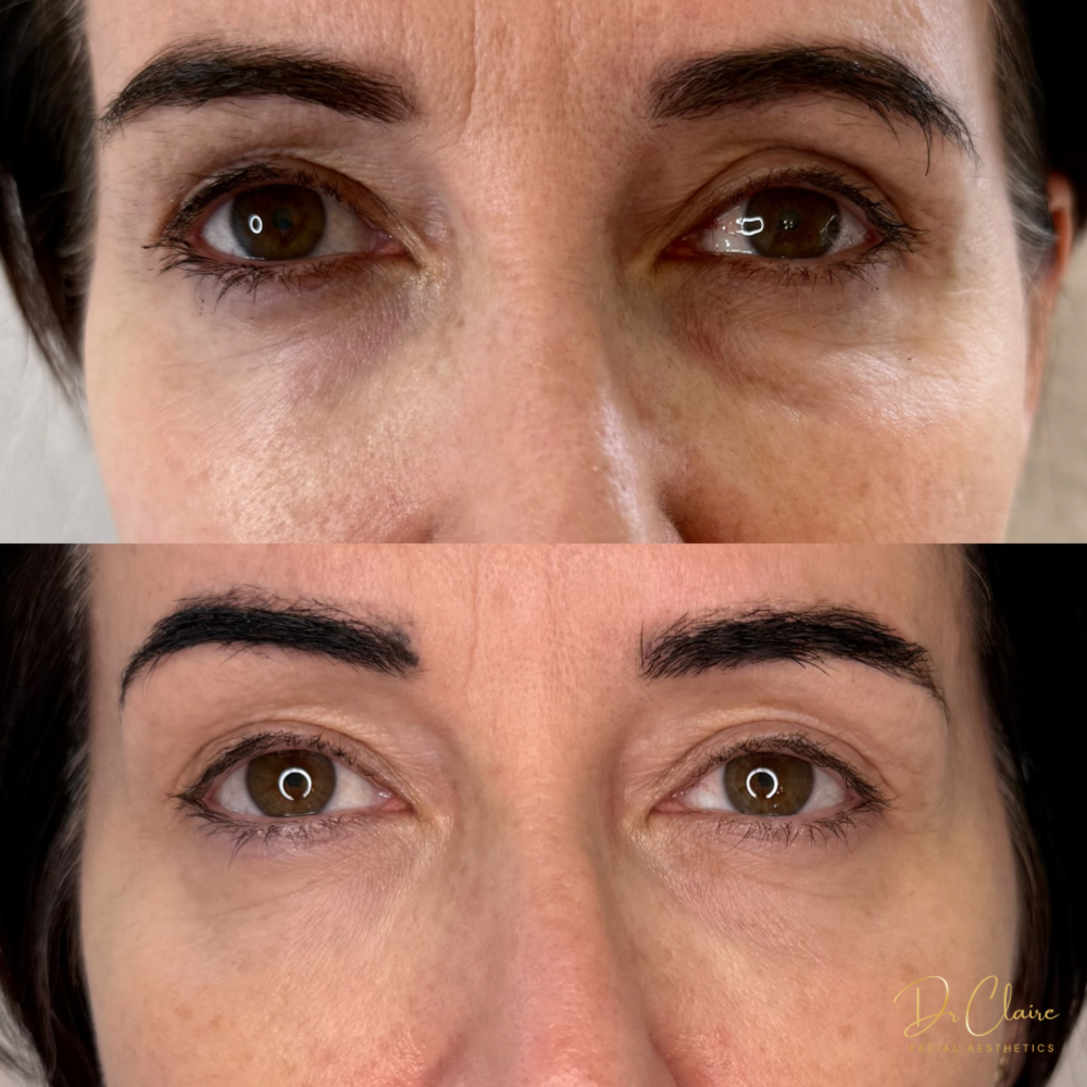 Transformations | Dr Claire Facial Aesthetics | Botox Chorley | Fillers Chorley | Aesthetics Chorley | Botox Treatments Chorley | Dermal Fillers Chorley | Aesthetic Enhancements Chorley