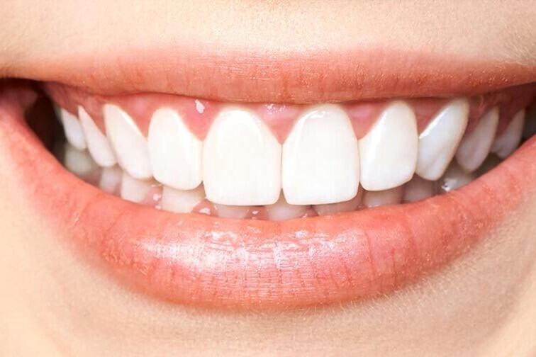 Results | K&amp;S Smiles