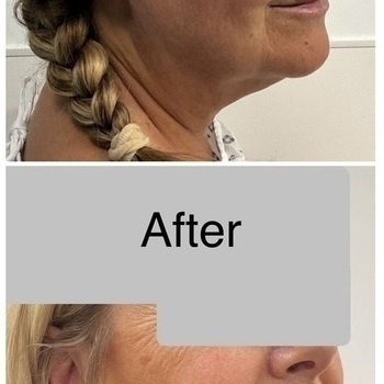 Gallery | FM Plastic Surgery Ltd  | Plastic Surgeon Newcastle | Cosmetic Surgery Newcastle | Skin and Hand Surgery North East