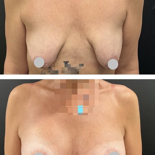 Gallery | FM Plastic Surgery Ltd  | Plastic Surgeon Newcastle | Cosmetic Surgery Newcastle | Skin and Hand Surgery North East