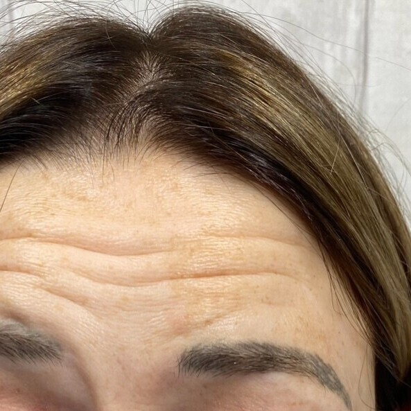 Before & After Results