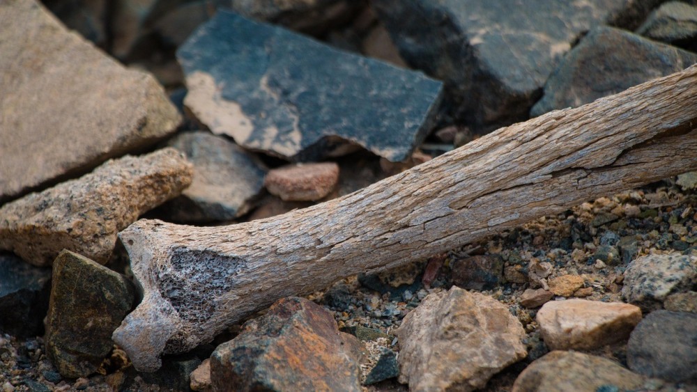 ஒஸ்ரியோபொறோசிஸ் | Osteoporosis