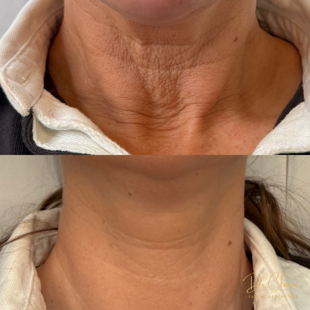 Transformations | Dr Claire Facial Aesthetics | Botox Chorley | Fillers Chorley | Aesthetics Chorley | Botox Treatments Chorley | Dermal Fillers Chorley | Aesthetic Enhancements Chorley