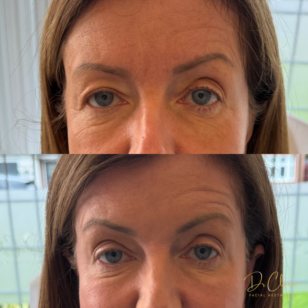 Transformations | Dr Claire Facial Aesthetics | Botox Chorley | Fillers Chorley | Aesthetics Chorley | Botox Treatments Chorley | Dermal Fillers Chorley | Aesthetic Enhancements Chorley