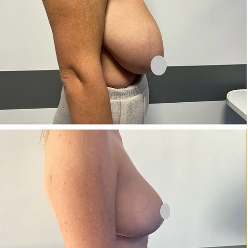 Gallery | FM Plastic Surgery Ltd  | Plastic Surgeon Newcastle | Cosmetic Surgery Newcastle | Skin and Hand Surgery North East
