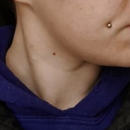 Before & After Results