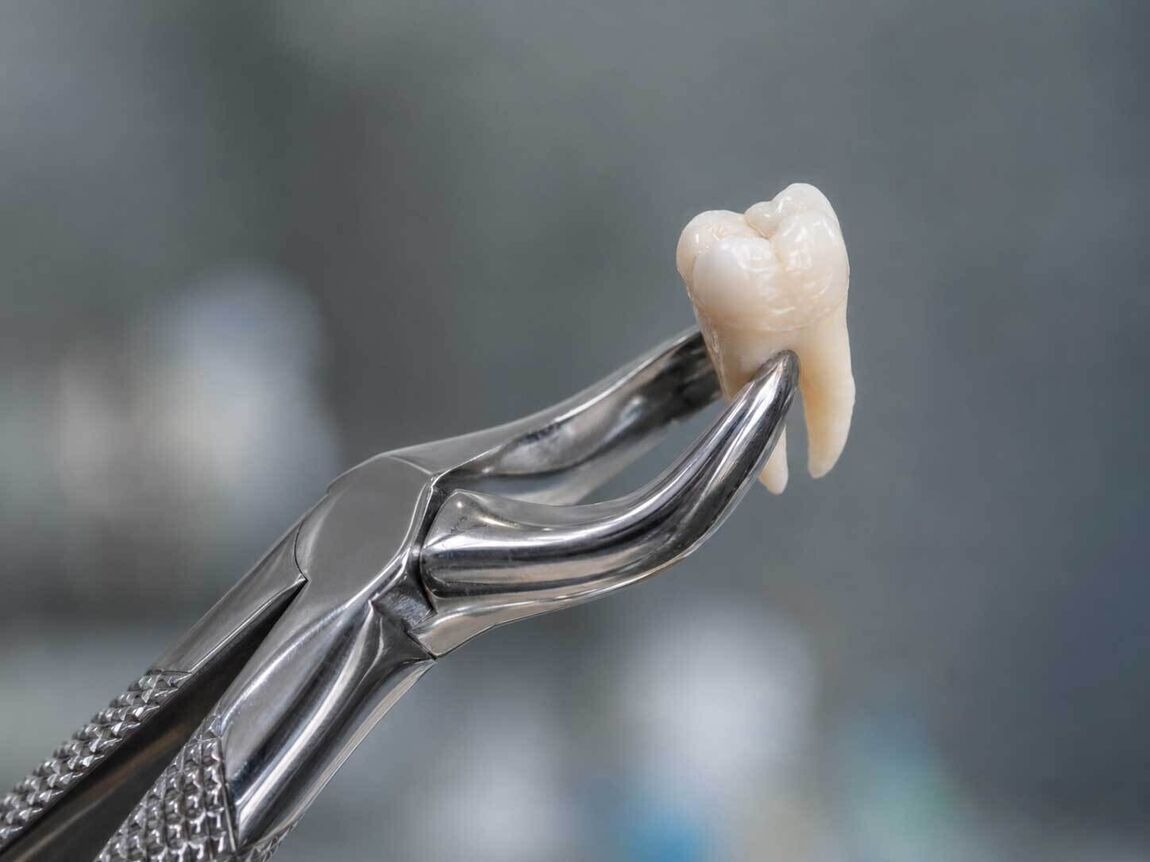Oral Surgery | Cramond House Dental Practice | Dentist Clitheroe Preston Manchester | Dental Implants Clitheroe Preston Manchester | Gum Surgery Clitheroe Preston Manchester