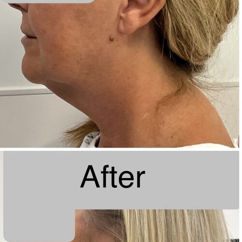 Gallery | FM Plastic Surgery Ltd  | Plastic Surgeon Newcastle | Cosmetic Surgery Newcastle | Skin and Hand Surgery North East