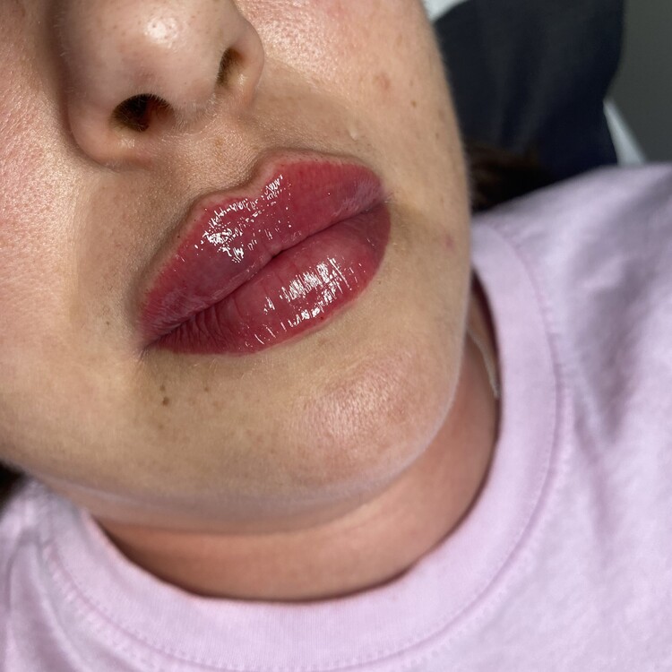 Before & After Results