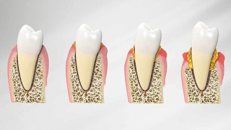 Advanced Dentistry | Cramond House Dental Practice | Dentist Clitheroe Preston Manchester | Dental Implants Clitheroe Preston Manchester | Gum Surgery Clitheroe Preston Manchester