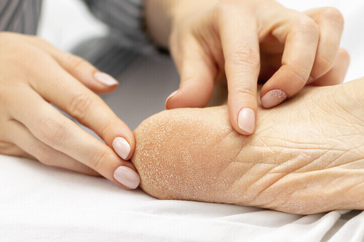 Podiatrist in Glossop | Shire Foot Clinic