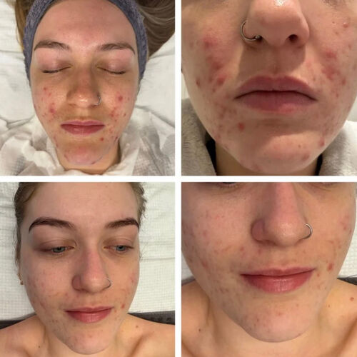 DERMALOGICA SKIN SERVICES | Creations Skincare Centre Ltd | Dermalogica Derby | Elemis Derby | Beauty Salon Mickleover