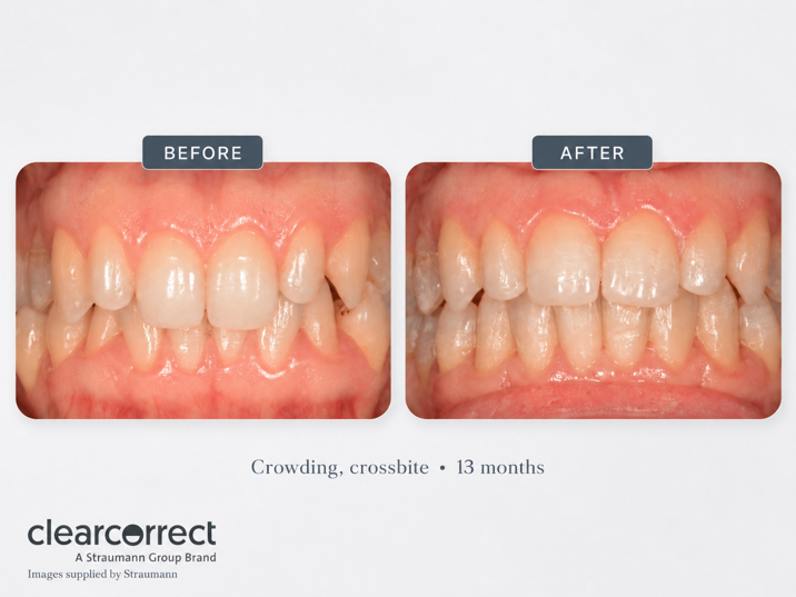 Orthodontics | Cramond House Dental Practice | Dentist Clitheroe Preston Manchester | Dental Implants Clitheroe Preston Manchester | Gum Surgery Clitheroe Preston Manchester
