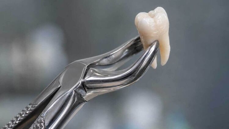 Advanced Dentistry | Cramond House Dental Practice | Dentist Clitheroe Preston Manchester | Dental Implants Clitheroe Preston Manchester | Gum Surgery Clitheroe Preston Manchester