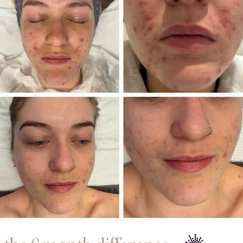 Gallery | Creations Skincare Centre Ltd | Dermalogica Derby | Elemis Derby | Beauty Salon Mickleover