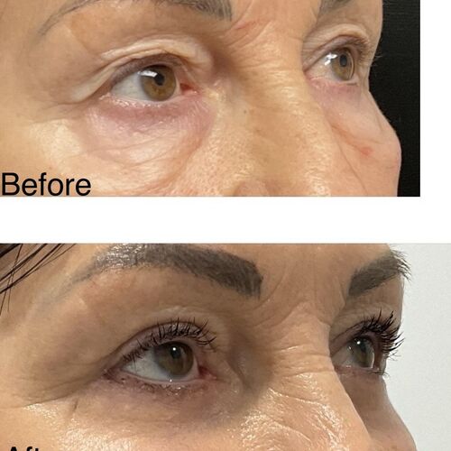 Gallery | FM Plastic Surgery Ltd  | Plastic Surgeon Newcastle | Cosmetic Surgery Newcastle | Skin and Hand Surgery North East
