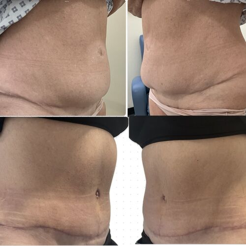 Gallery | FM Plastic Surgery Ltd  | Plastic Surgeon Newcastle | Cosmetic Surgery Newcastle | Skin and Hand Surgery North East