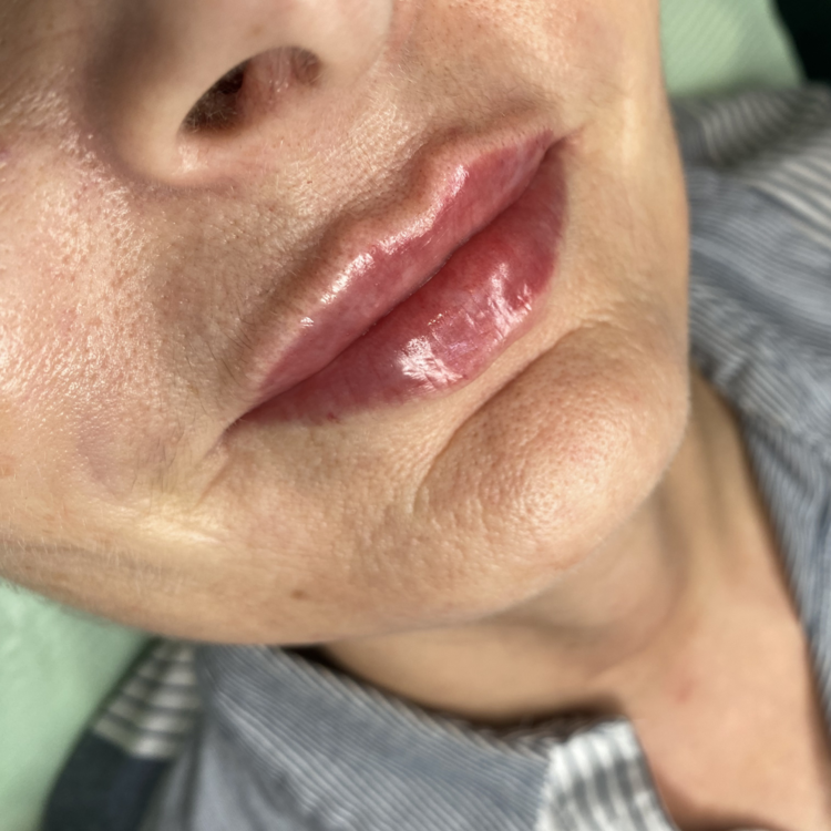 Before & After Results