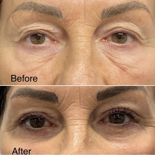 Gallery | FM Plastic Surgery Ltd  | Plastic Surgeon Newcastle | Cosmetic Surgery Newcastle | Skin and Hand Surgery North East