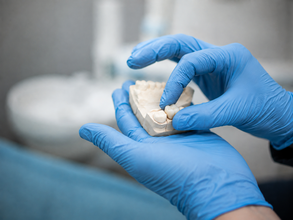 Crowns &amp; Bridges | Cramond House Dental Practice | Dentist Clitheroe Preston Manchester | Dental Implants Clitheroe Preston Manchester | Gum Surgery Clitheroe Preston Manchester