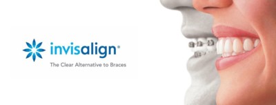 Invisalign teeth straightening, clear aligner, Personalised Invisalign Eyes & Smiles in North London