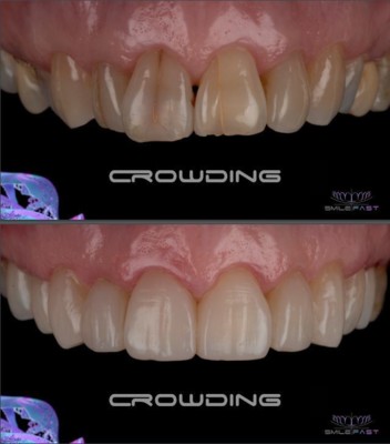 Amazing Smile Makeovers in Barnet