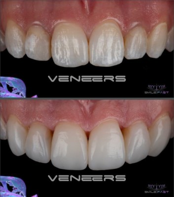 Amazing Smile Makeovers in North London N11