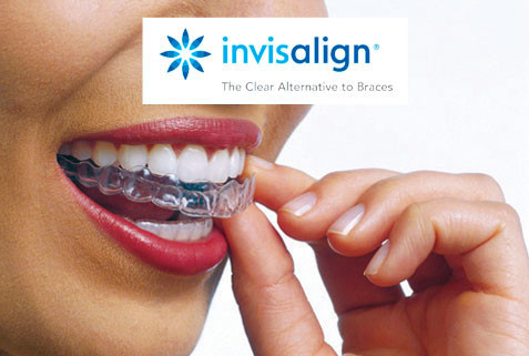 We are now an Official Invisalign Provider!