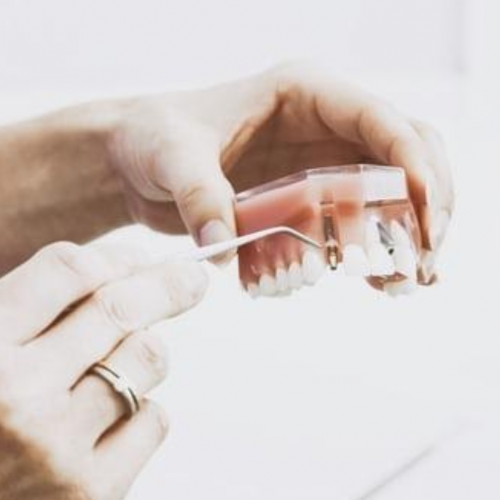 Some Serious Dental Warning Signs You Should Never Ignore