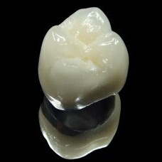 High strength, long term and reliable dental crowns at Eyes & Smiles Dental Clinic Finchley