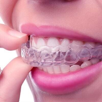 Clear Invisalign Teeth Straightening At Eyes & Smiles Dental Clinic in Bounds Green North London N11, aligners, retainer, removable, invisible, straight teeth, crowding, crooked, gaps, overbite, cross bite, open bite, teeth stick out, ABC,