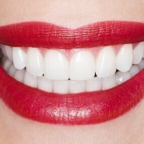 Cosmetic Treatment and Smile Makeovers At Eyes & Smiles Dental Clinic in  Smile Makeover  North London N11, hollywood smile, essex smile, straight white teeth, veneers, composite bonding, porcelain veneers, wedding, perfect teeth