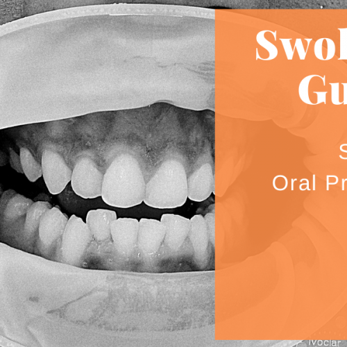 Swollen Gums Can Be A Severe Oral Problem