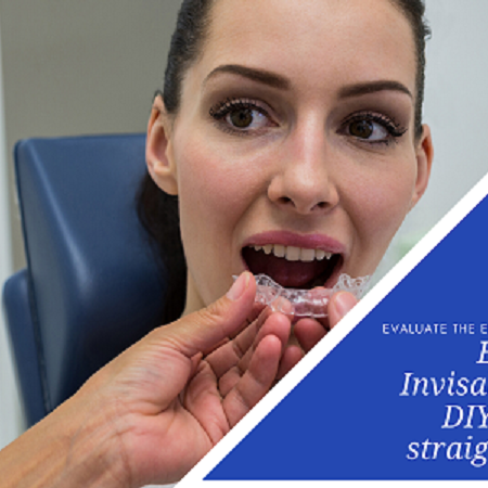 Evaluate The Efficiency Of Braces, Invisalign Or DIY Teeth Straighteners