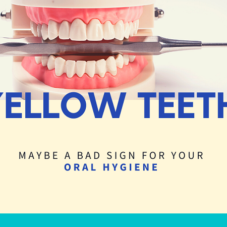 Yellow Teeth May Be a Bad Sign To Your Oral Health And Hygiene