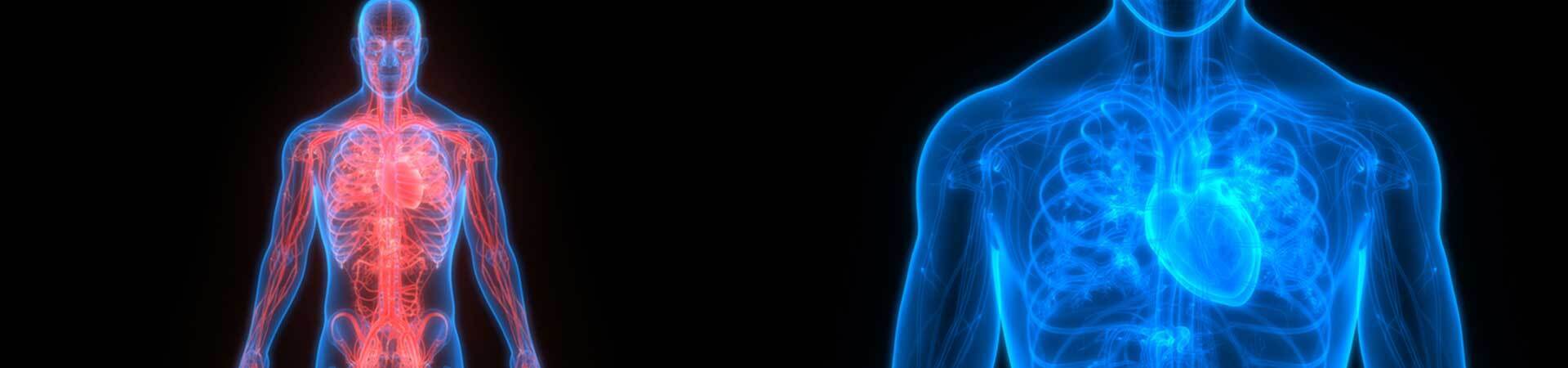 Arterial & Aortic Aneurysm - Banner 1