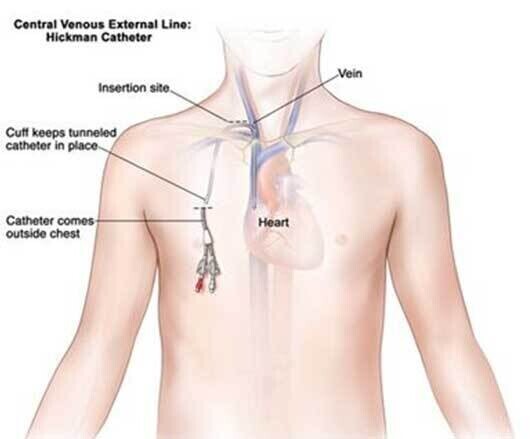 Vascular Access/Lines - Image 2